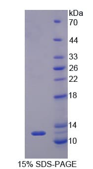 Bovine CCL11 / Eotaxin Protein (Recombinant His)