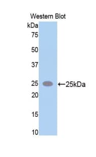SPTAN1 / Alpha Fodrin Antibody (aa2071-2269, FITC)