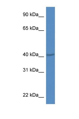 PRDM12 Antibody (aa161-210)