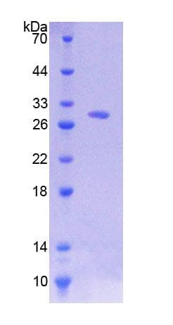 Human CD38 Protein (Recombinant His-T7)