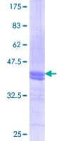 Human ANXA2 / Annexin A2 Protein (Recombinant GST, N-terminus)