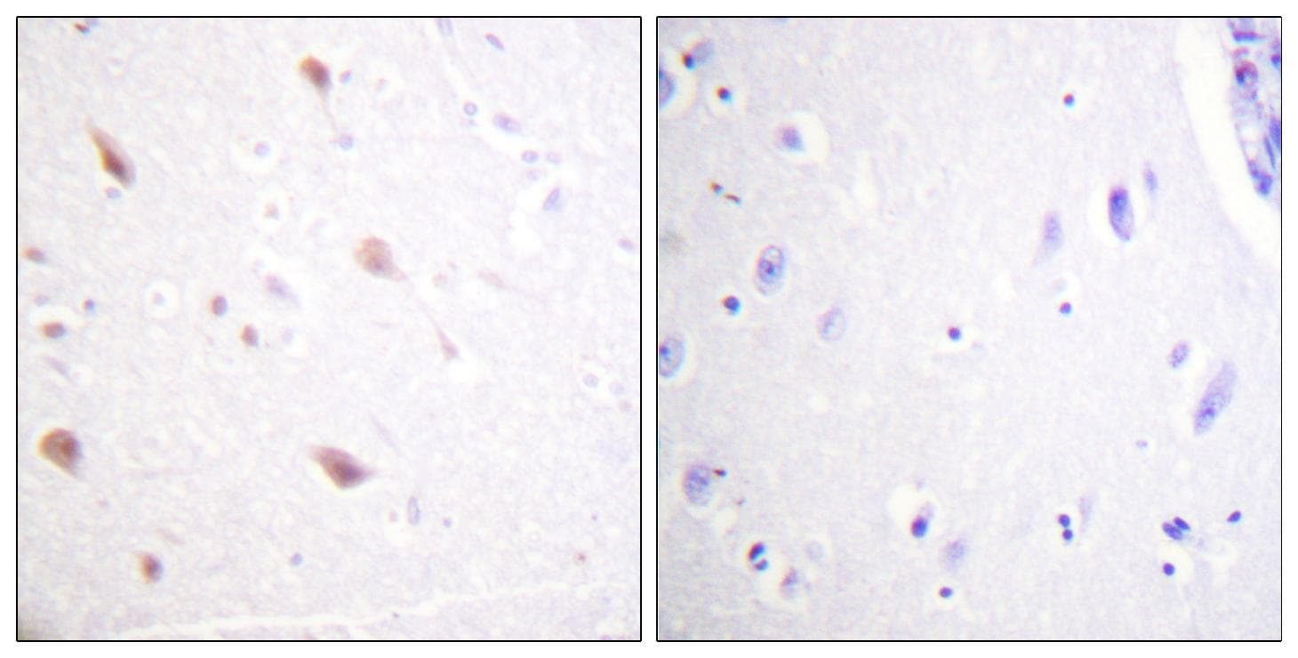 Polyclonal Rabbit anti-Human NIFK / MKI67IP Antibody (phospho-Thr234, IHC, IF)