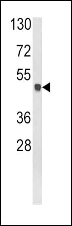 Polyclonal Rabbit anti-Human GLUL / Glutamine Synthetase Antibody (aa70-96, IHC, WB)