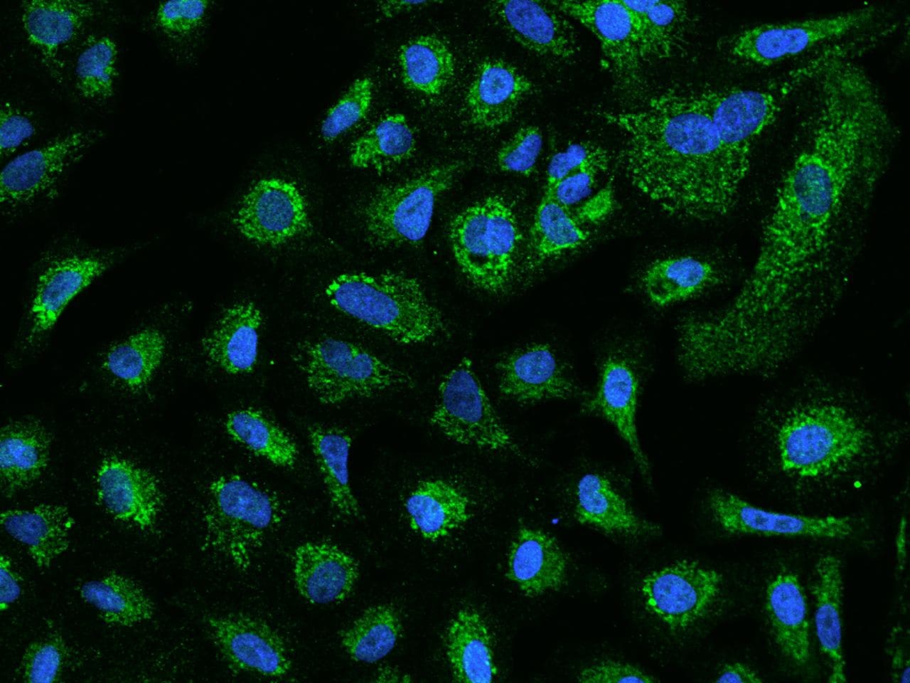 ACADVL Antibody