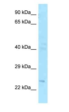 Polyclonal Rabbit anti-Human FGF20 Antibody (aa138-187, WB)