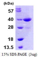 Human MAP2K3 / MEK3 / MKK3 Protein (Recombinant His)