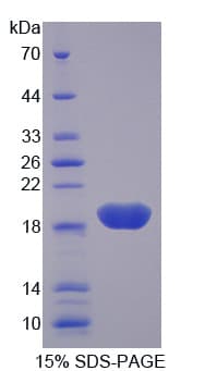 Rat AGER / RAGE Protein (Recombinant His-T7)