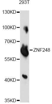 Polyclonal Rabbit anti-Human ZNF248 Antibody (WB)