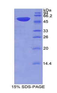Mouse THBS2 / Thrombospondin 2 Protein (Recombinant His-GST)