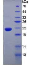 Mouse TNF Alpha Protein (Recombinant His, N-Terminal)