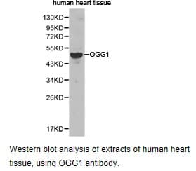 Polyclonal Rabbit anti-Human OGG1 Antibody (IHC, WB)