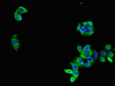 Polyclonal Rabbit anti-Human C-TAK1 / MARK3 Antibody (IHC, IF)
