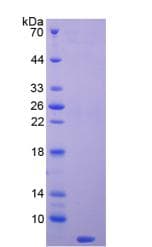 Mouse TMSB4X / Thymosin Beta-4 Protein (Recombinant 6His, N-terminus)