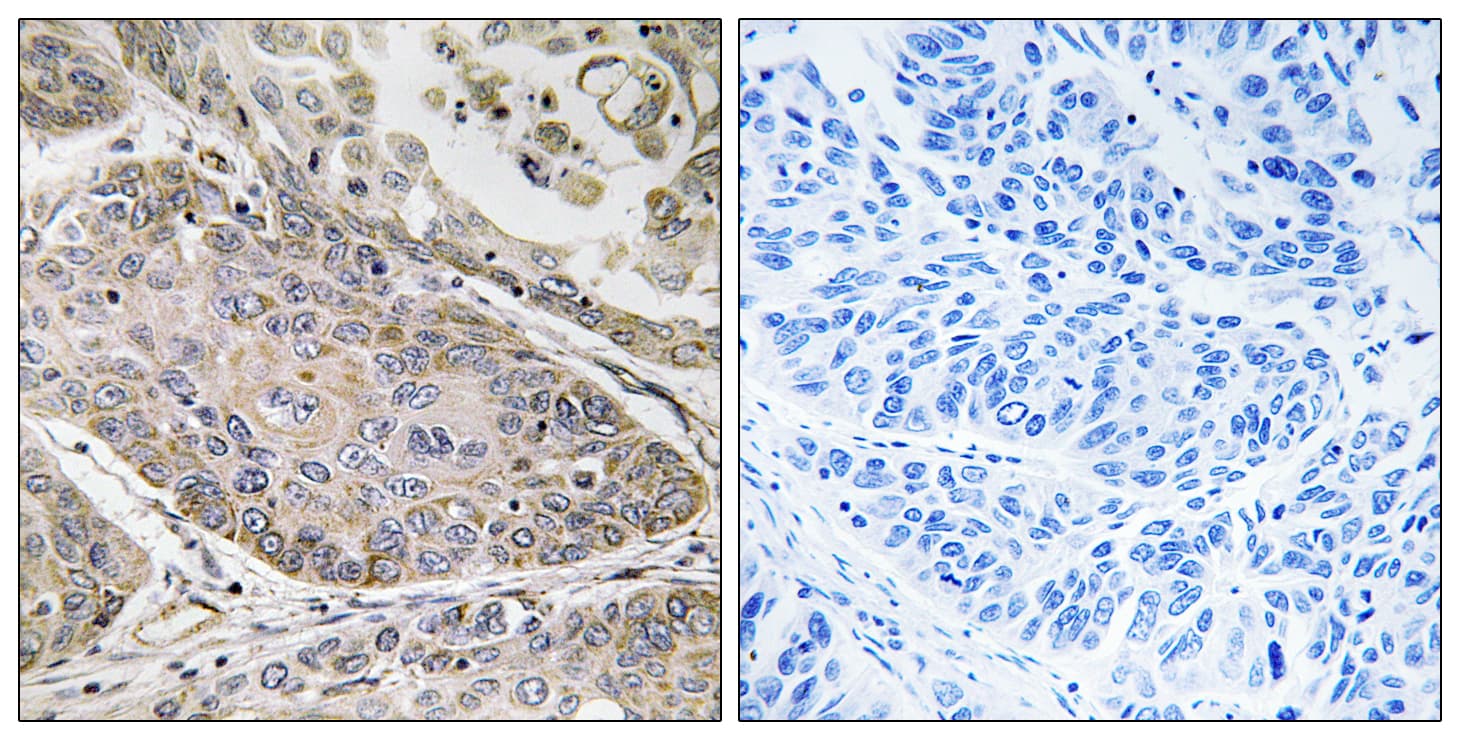 PLA2G4E Antibody (aa401-450)