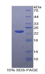 Rabbit MMP12 Protein (Recombinant His)