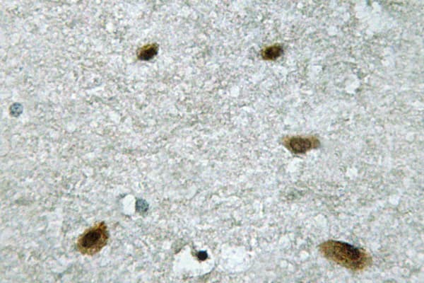 MAPK14 / p38 Antibody (His174)