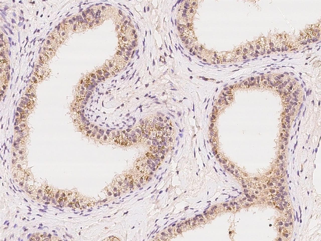 Polyclonal Rabbit anti-Human FKBP2 Antibody (IHC)
