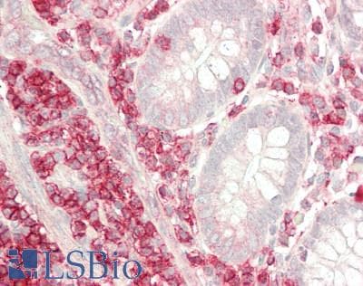 IHC-plus™ Polyclonal Rabbit anti-Human CD45 / LCA Antibody (aa336-364, IHC, WB)