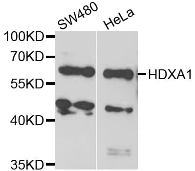 Polyclonal Rabbit anti-Human HOXA1 Antibody (IHC, IF, WB)