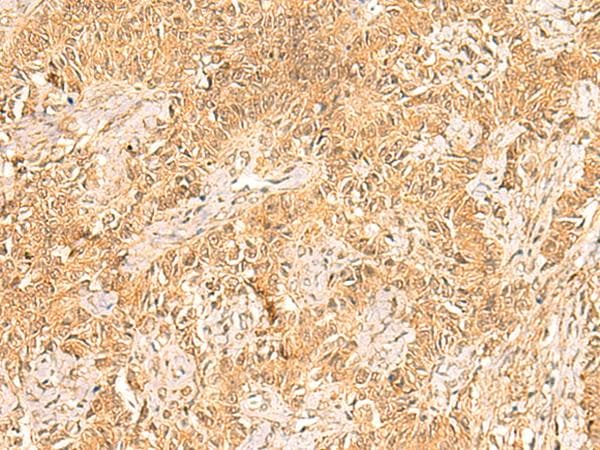 TRMT112 Antibody