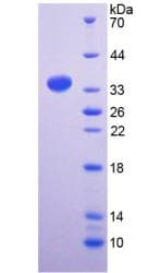 Human PKP2 / Plakophilin 2 Protein (Recombinant His-T7)