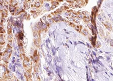 BIK Antibody (phospho-Thr33)