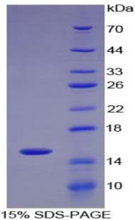 Human SPTAN1 / Alpha Fodrin Protein (Recombinant His)
