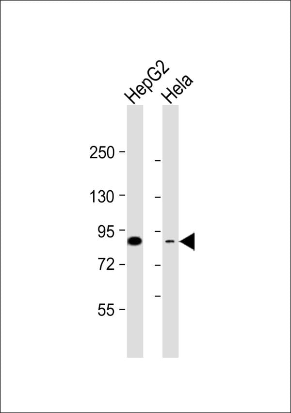 TEM1 / CD248 Antibody