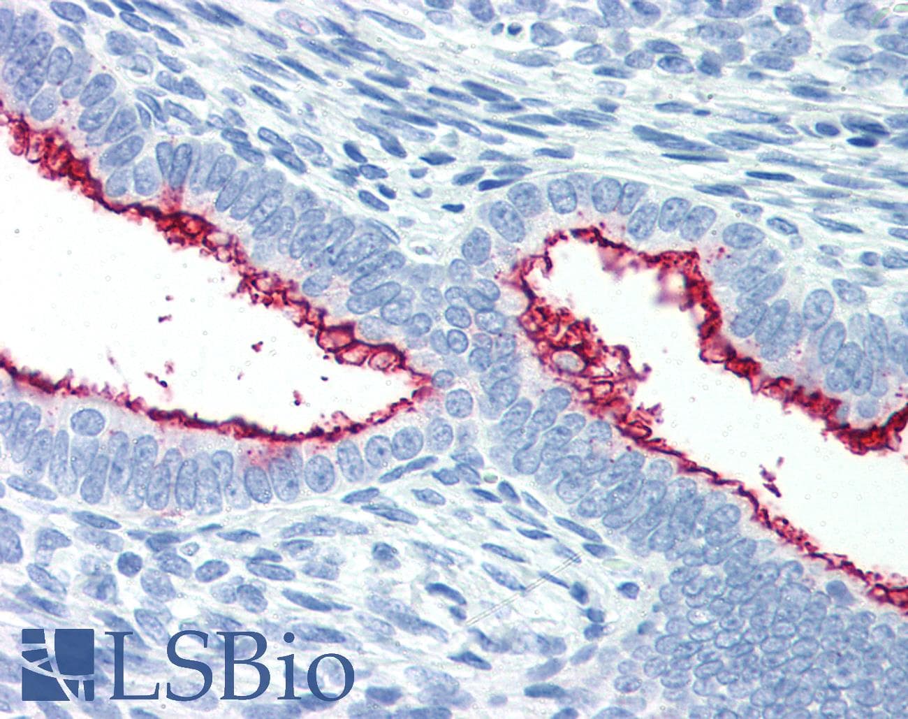PathPlus™ MUC16 / CA125 Antibody (clone X306)