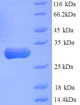 Human CBR / CBR1 Protein (Recombinant His)