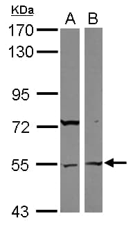 Polyclonal Rabbit anti-Human ASB3 Antibody (WB)