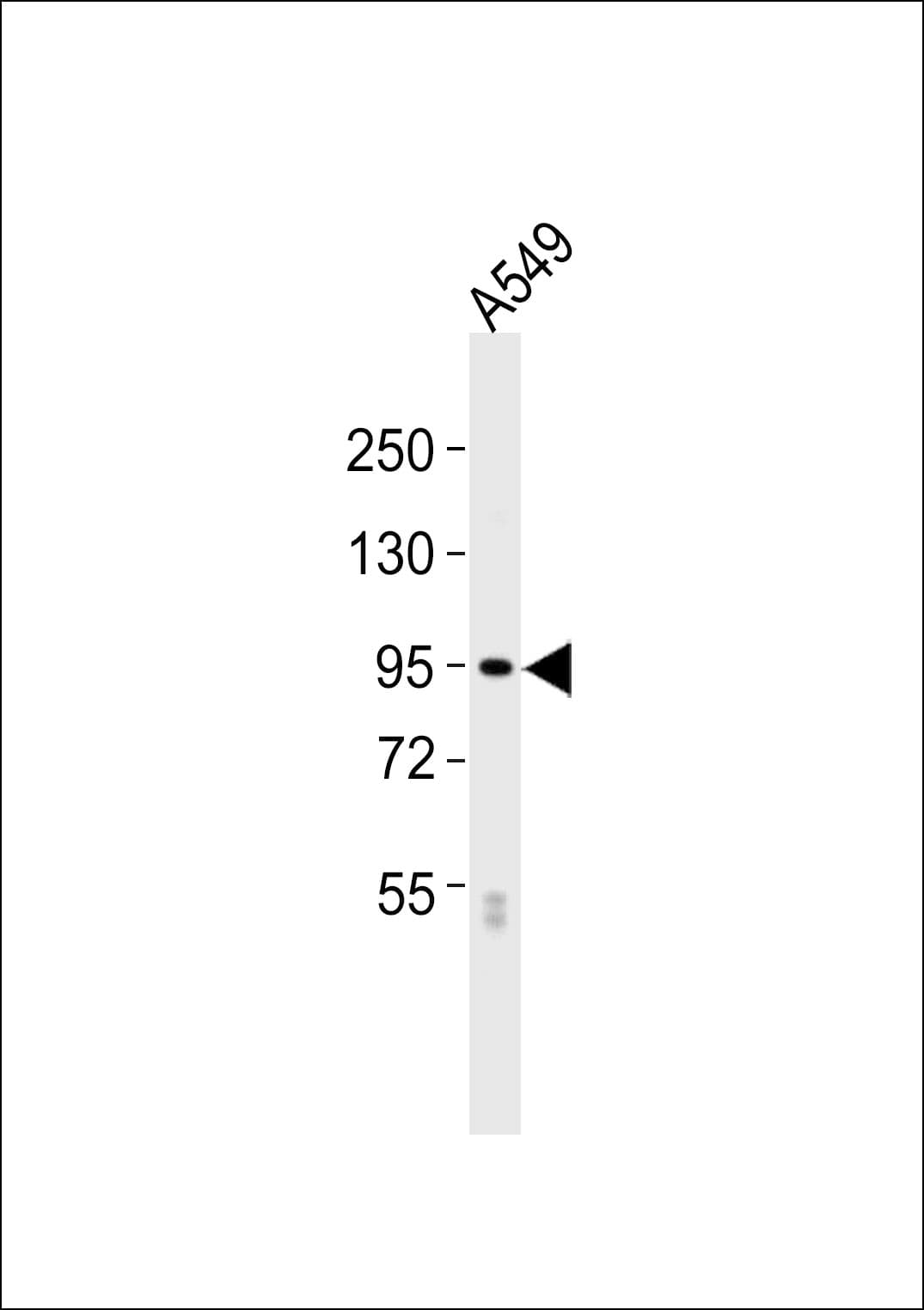 Polyclonal Rabbit anti-Human COL6A2 / Collagen VI Alpha 2 Antibody (WB)