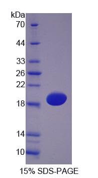 Mouse HBA1 Protein (Recombinant 6His-T7, N-terminus)