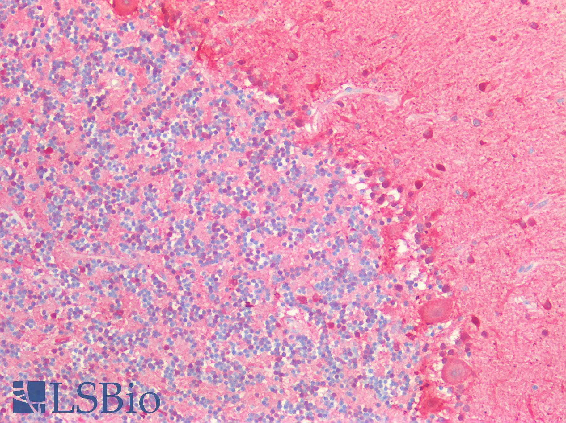 IHC-plus™ PVALB / Parvalbumin Antibody