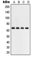 RELA / NFKB p65 Antibody (Internal)