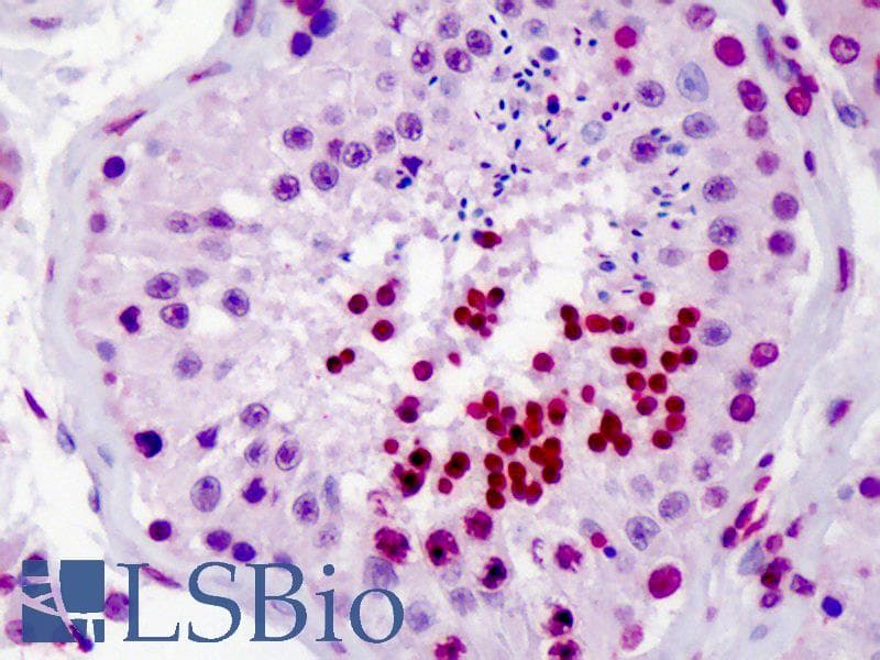 IHC-plus™ Polyclonal Rabbit anti-Human CDC25A Antibody (aa271-300, IHC, WB)