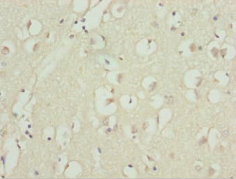 UBE1L2 / UBE1L2 Antibody