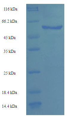 Human HPTPB / PTPRB Protein (Recombinant His-SUMO)