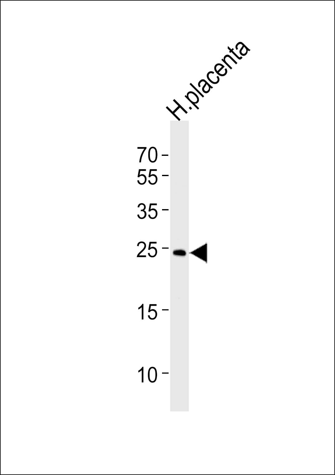 ANP32B Antibody (aa17-45)