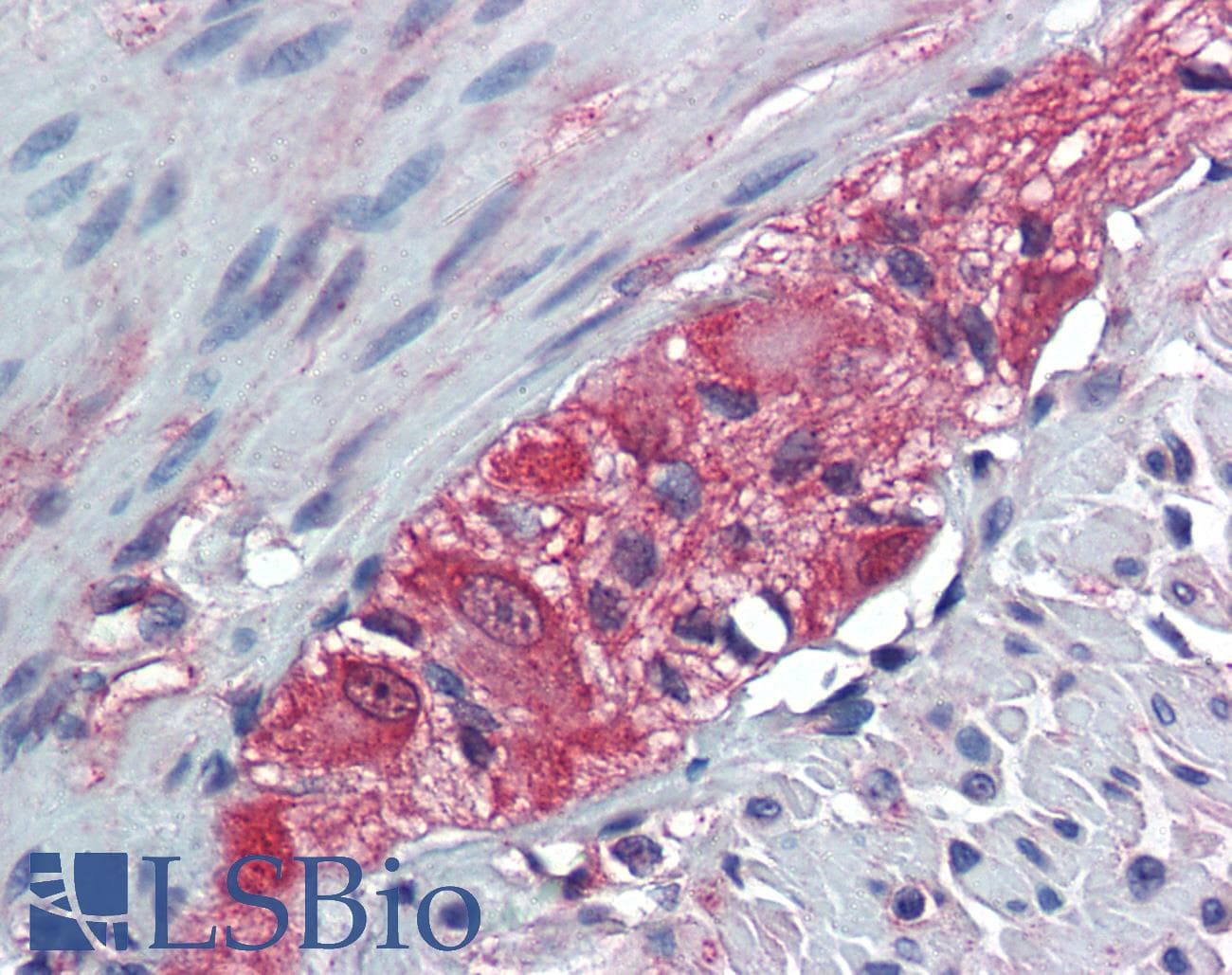 IHC-plus™ TXLNB Antibody (Internal)