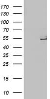 LPL / Lipoprotein Lipase Antibody (aa28-475, clone OTI6A10)