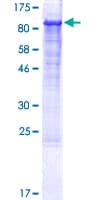 Human ITGB1 / Integrin Beta 1 / CD29 Protein (Recombinant GST)