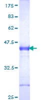 Human DKK1 Protein (Recombinant GST, N-terminus)