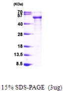 Human MAPT / Tau Protein (Recombinant His)