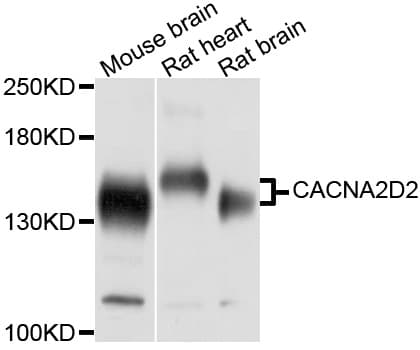 Polyclonal Rabbit anti-Human CACNA2D2 Antibody (WB)
