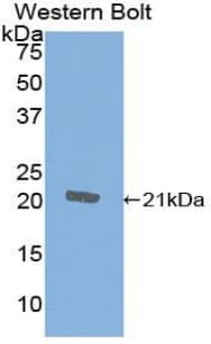 CTLA4 / CD152 Antibody (aa41-192)