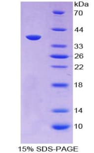 Rat LIG1 / DNA Ligase 1 Protein (Recombinant His-T7)