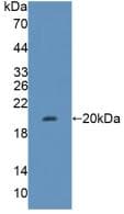 FH / Fumarase / MCL Antibody (aa45-188)