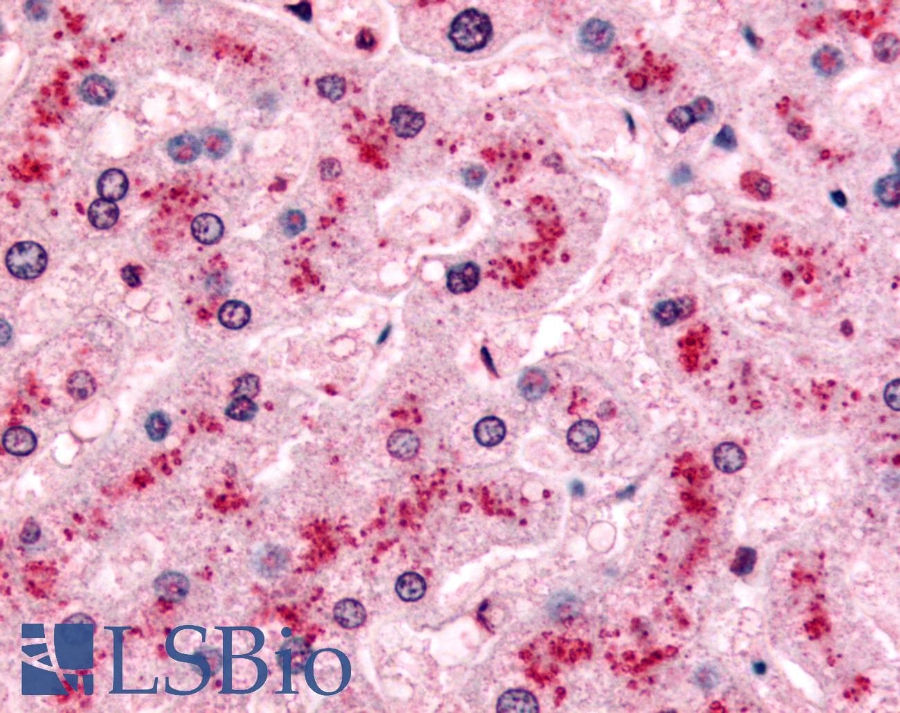 IHC-plus™ PYGL Antibody (Internal)
