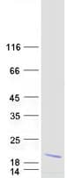 Human HBA2 / Hemoglobin Alpha 2 Protein (Recombinant Myc-DDK (Flag))